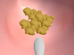 Spel Earwax Clinic på nätet