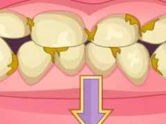 Spel Bad Teeth Makeover på nätet