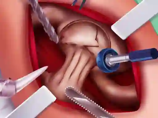 Spel Princess Hips Surgery på nätet