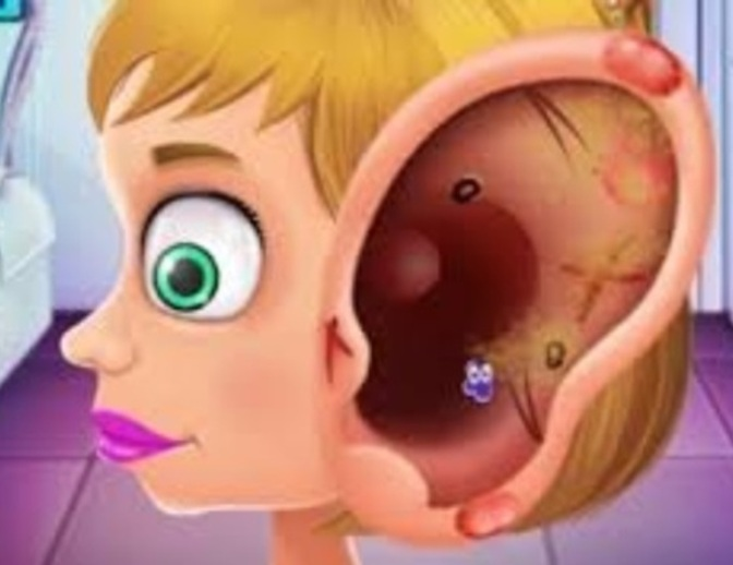 Spel Barnläkare som behandlar öron  på nätet
